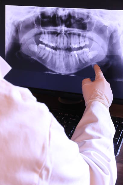 Best Knocked-Out Tooth (Avulsed Tooth) Treatment in River Grove, IL