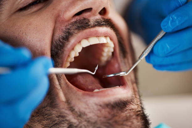 Best Emergency Treatment for Oral Infections in River Grove, IL