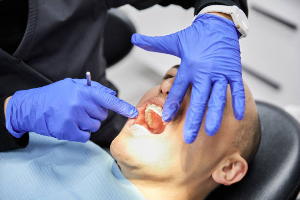 Best Broken or Chipped Tooth Repair in River Grove, IL